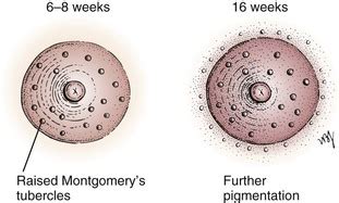 areola during pregnancy pictures